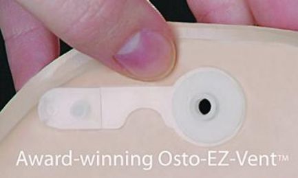 Osto-EZ-Vent Ostomy Venting Device